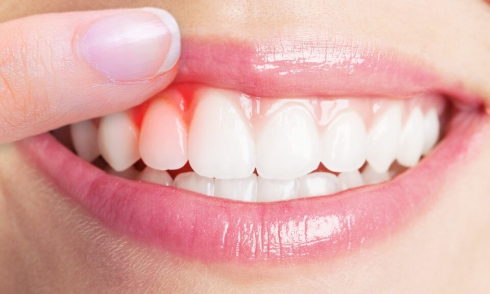 Oral health